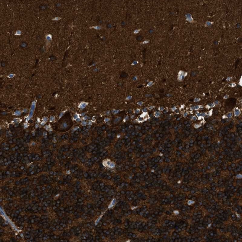 Anti-ZSWIM5 Antibody