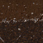 Anti-ZSWIM5 Antibody