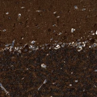 Anti-ZSWIM5 Antibody