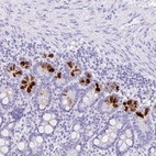 Immunohistochemical staining of human small intestine shows strong cytoplasmic positivity in Paneth cells.