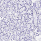 Anti-GUCA2A Antibody