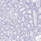 Immunohistochemical staining of human stomach shows no cytoplasmic positivity in glandular cells as expected.