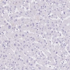 Immunohistochemical staining of human liver shows no cytoplasmic positivity in hepatocytes as expected.