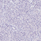 Immunohistochemical staining of human pancreas shows no cytoplasmic positivity in exocrine glandular cells as expected.