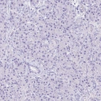 Immunohistochemical staining of human pancreas shows no cytoplasmic positivity in exocrine glandular cells as expected.