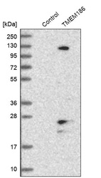 Western blot analysis in control (vector only transfected HEK293T lysate) and TMEM186 over-expression lysate (Co-expressed with a C-terminal myc-DDK tag (~3.1 kDa) in mammalian HEK293T cells, LY414582).