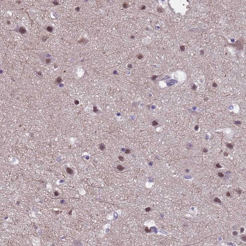 Anti-ZNF248 Antibody