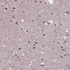 Anti-ZNF248 Antibody