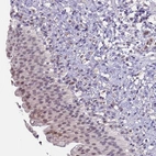 Immunohistochemical staining of human urinary bladder shows weak nuclear positivity in subset of urothelial cells.