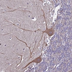 Immunohistochemical staining of human cerebellum shows moderate cytoplasmic positivity in Purkinje cells.