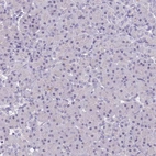 Immunohistochemical staining of human pancreas shows no positivity in exocrine glandular cells as expected.