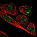 Immunofluorescent staining of human cell line PC-3 shows localization to nucleoplasm.