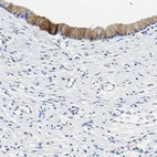 Immunohistochemical staining of human cervix, uterine shows high expression.
