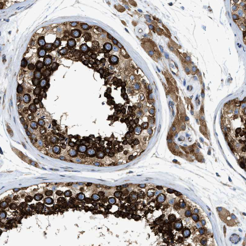 Anti-FXR1 Antibody