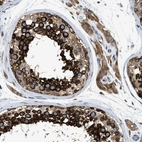 Anti-FXR1 Antibody