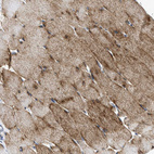 Immunohistochemical staining of human skeletal muscle shows moderate granular cytoplasmic positivity in myocytes.
