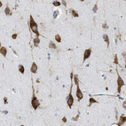 Immunohistochemical staining of human cerebral cortex shows strong cytoplasmic positivity in neurons.