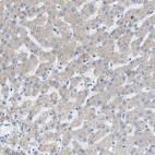 Immunohistochemical staining of human liver shows very weak cytoplasmic positivity in hepatocytes.