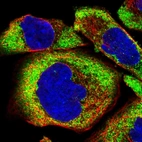 Immunofluorescent staining of human cell line A-431 shows localization to cytosol.
