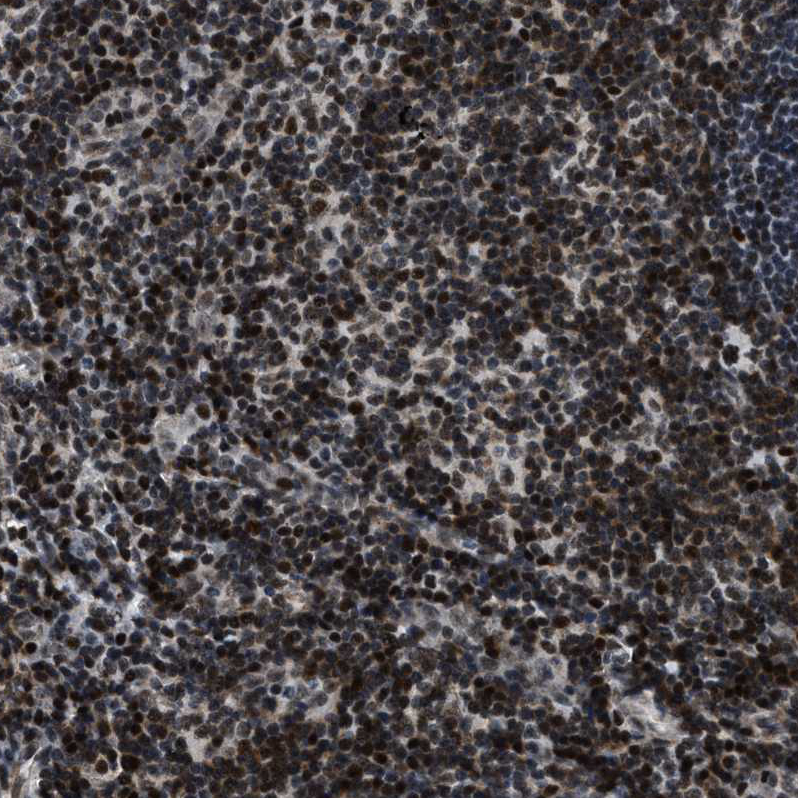 Anti-SMARCB1 Antibody