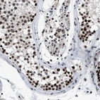 Immunohistochemical staining of human testis shows strong nuclear positivity in cells in seminiferous ducts.