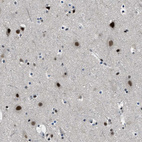 Immunohistochemical staining of human cerebral cortex shows strong nuclear positivity in neurons.