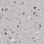 Anti-SMARCB1 Antibody