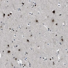 Immunohistochemical staining of human cerebral cortex shows strong nuclear positivity in neurons.