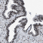 Anti-SMARCB1 Antibody