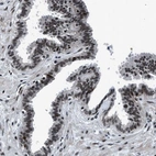 Immunohistochemical staining of human fallopian tube shows strong nuclear positivity in glandular cells.