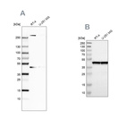 Anti-SMARCB1 Antibody