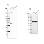 Western blot analysis using Anti-SMARCB1 antibody HPA018248 (A) shows similar pattern to independent antibody HPA019127 (B).