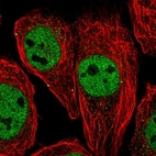 Immunofluorescent staining of human cell line A-431 shows localization to nucleoplasm & vesicles.