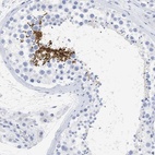 Anti-SPATA3 Antibody