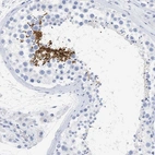 Immunohistochemical staining of human testis shows high expression.