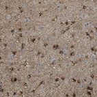 Immunohistochemical staining of human cerebral cortex shows strong cytoplasmic positivity in glial cells.