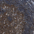 Immunohistochemical staining of human tonsil shows strong cytoplasmic positivity in germinal center cells.