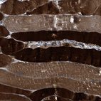 Immunohistochemical staining of human skeletal muscle shows strong cytoplasmic positivity in myocytes.