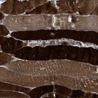 Immunohistochemical staining of human skeletal muscle shows strong cytoplasmic positivity in myocytes.