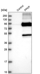 Western blot analysis in control (vector only transfected HEK293T lysate) and PFKP over-expression lysate (Co-expressed with a C-terminal myc-DDK tag (~3.1 kDa) in mammalian HEK293T cells, LY400932).