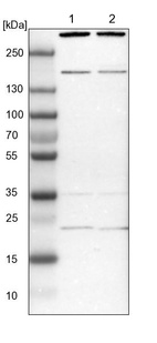 Lane 1: NIH-3T3 cell lysate (Mouse embryonic fibroblast cells)_br/_Lane 2: NBT-II cell lysate (Rat Wistar bladder tumour cells)