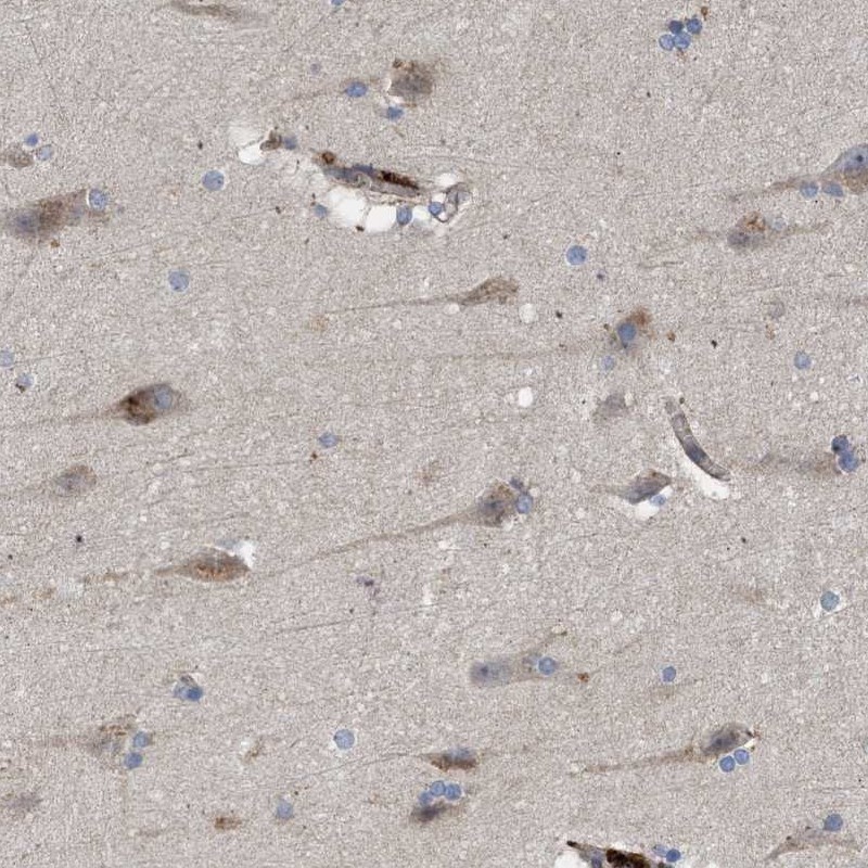 Anti-ARHGEF4 Antibody