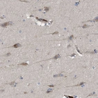 Anti-ARHGEF4 Antibody