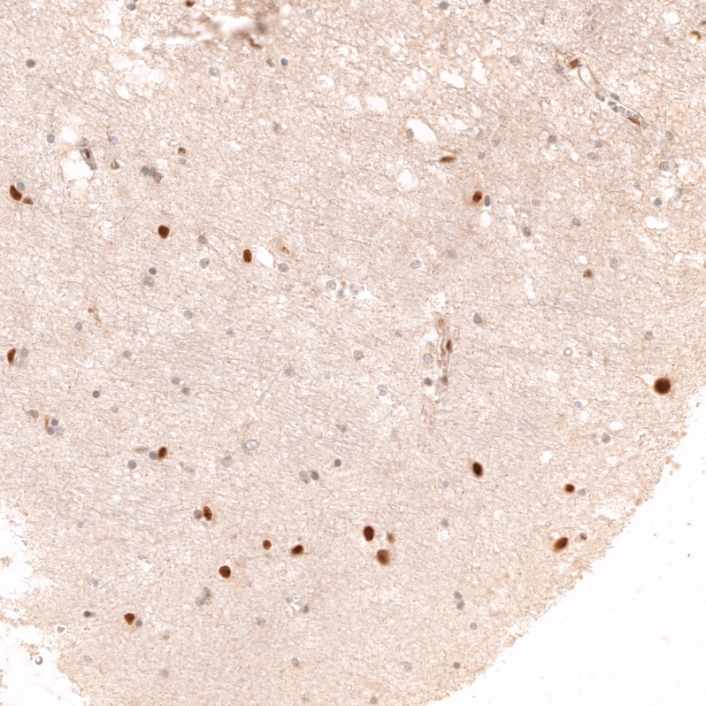Anti-ADARB1 Antibody