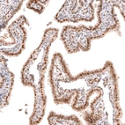 Immunohistochemical staining of human fallopian tube shows moderate nuclear positivity in glandular cells.