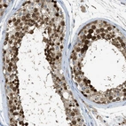 Immunohistochemical staining of human testis shows strong nuclear positivity in cells in seminiferous ducts.