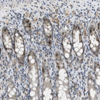 Immunohistochemical staining of human rectum shows strong nuclear positivity in a subset of glandular cells.