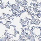 Immunohistochemical staining of human lung shows no positivity in pneumocytes as expected.