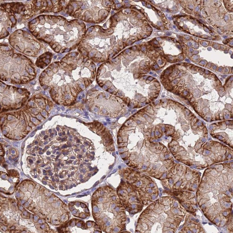 Anti-ZNF248 Antibody