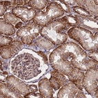 Anti-ZNF248 Antibody